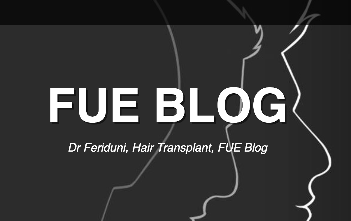 FUE blog