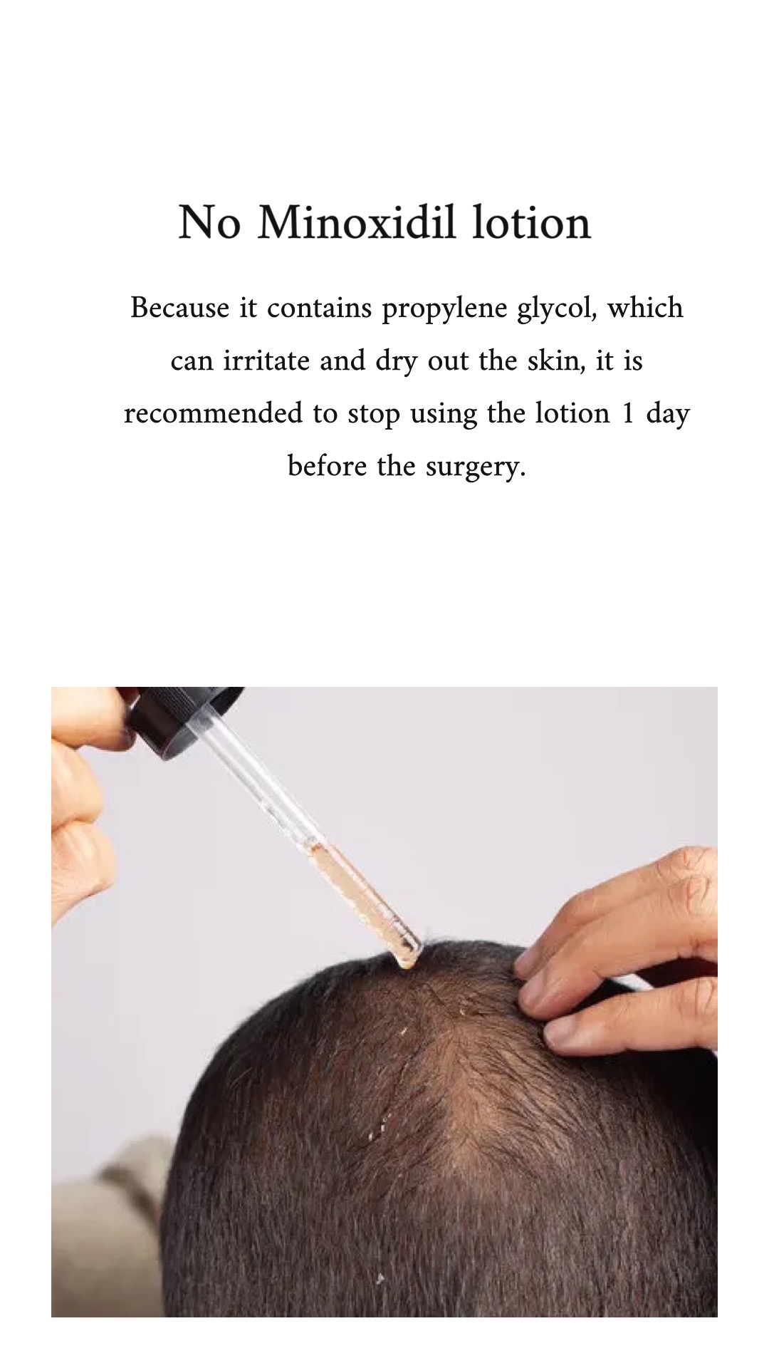 page2_5 Hair Transplantation - Dr. Feriduni
