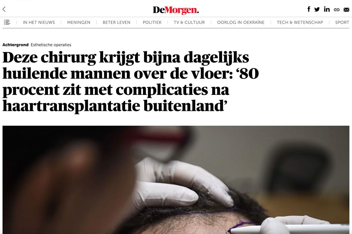 Dr. Feriduni in Belgian newspaper De Morgen on repair hair transplants